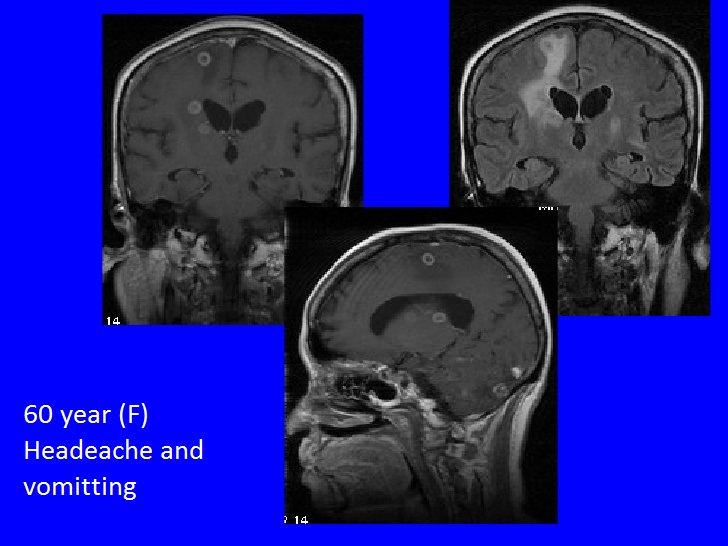 Spot The Diagnosis